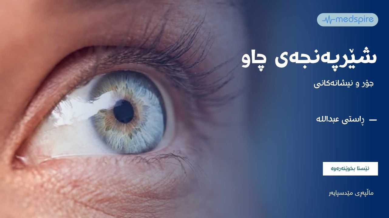 شێرپەنجەی چاو چییە؟ جۆر و نیشانەکانی بزانە